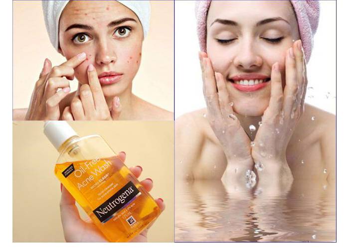 sữa rửa mặt neutrogena oil-free acne wash sheis